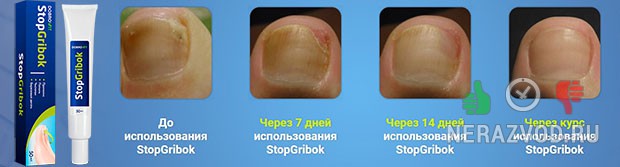 STOPGRIBOK от грибка ногтей и кожи