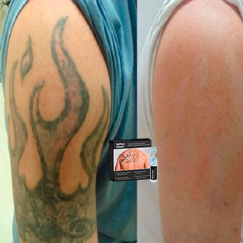 tattooclean крем для удаления тату