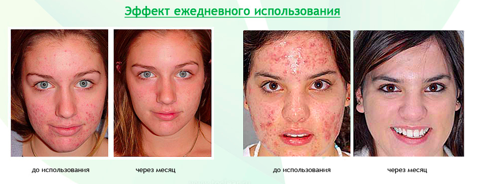 Действие очищающей щетки для лица Clear Skin (Клиар Скин)